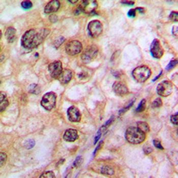 AKT (pY474) Antibody