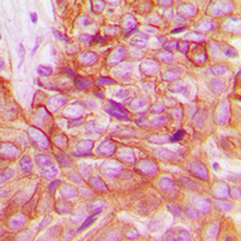 Alpha-adducin Antibody