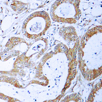 TRADD Antibody