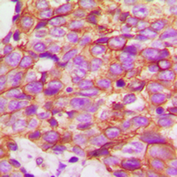 ECHOS1 Antibody