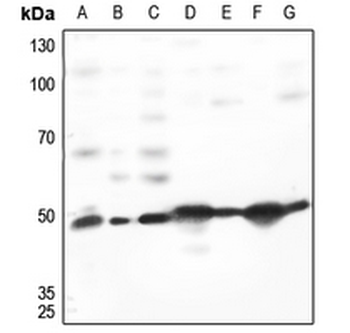 TACSTD2 Antibody