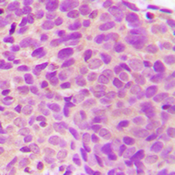 MST3 Antibody