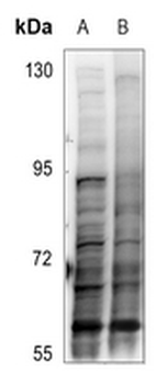 SMAD3 (pT179) Antibody
