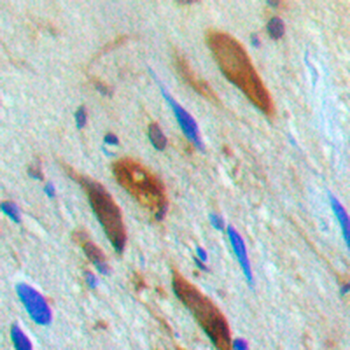 SMAD3 (pT179) Antibody