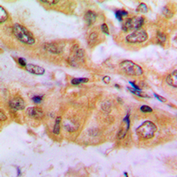 SMAD2 (pS467) Antibody