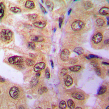 SIAH2 Antibody