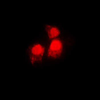 SIAH2 Antibody