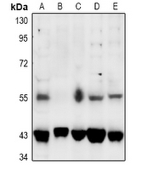SGK1/2 (pT256/253) Antibody