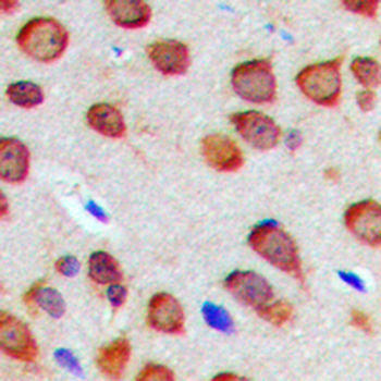 Nogo Antibody