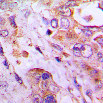 RPLP2 Antibody