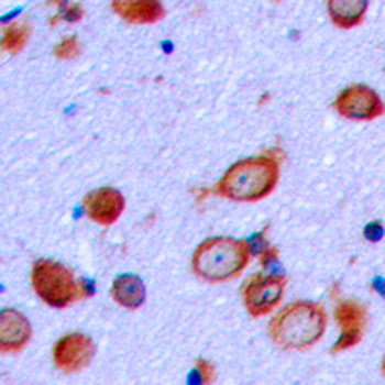 PTHR1 Antibody