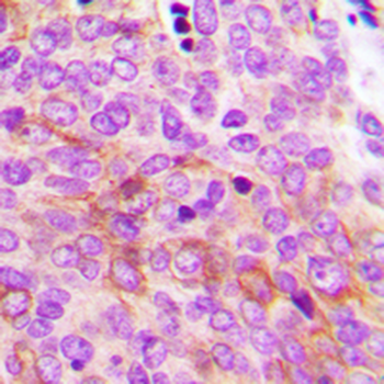 AMPK gamma 2 Antibody