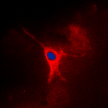 AMPK gamma 2 Antibody