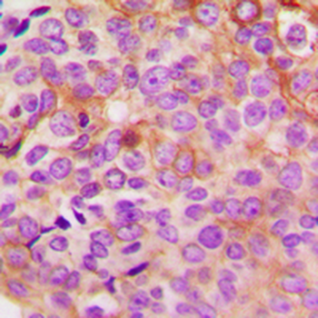 PKA C gamma Antibody
