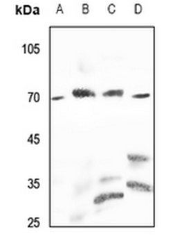 PPP2R5D Antibody