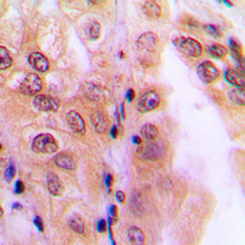 PPP2R5D Antibody