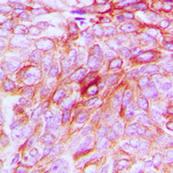 Phospholipase D4 Antibody