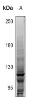 NOTCH1 Antibody