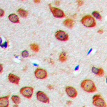 NOTCH1 Antibody