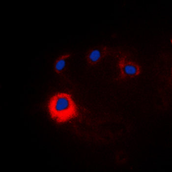 NOTCH1 Antibody