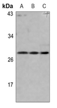 pro-NGF beta Antibody
