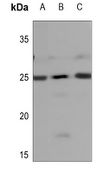 NDUFB9 Antibody