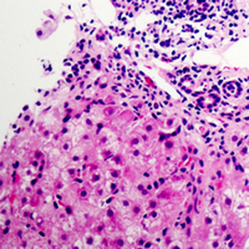 NDUFB9 Antibody