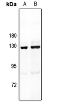 MYBPC1 Antibody