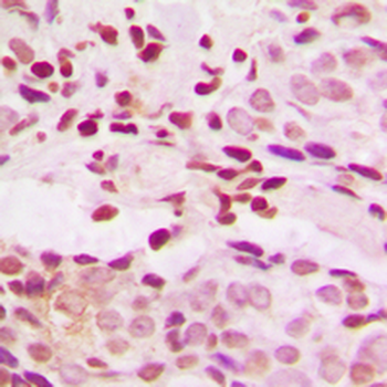 JUNB (pS259) Antibody