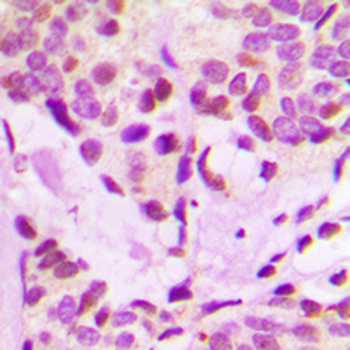 IRX3 Antibody