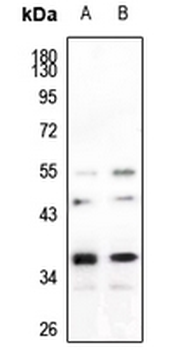 hnRNP A2/B1 Antibody