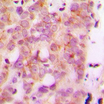 HLA-H Antibody