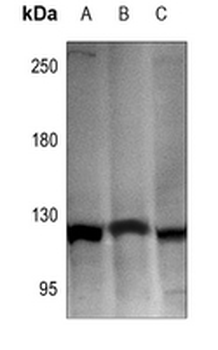 Hexokinase 1 Antibody