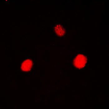 Hexokinase 1 Antibody