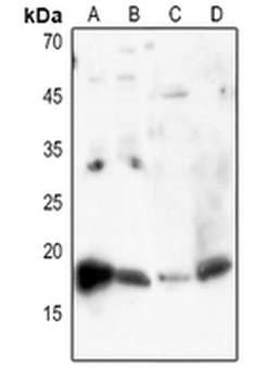 Histone H3 (AcK27) Antibody