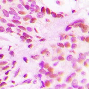 Histone H3 (AcK27) Antibody