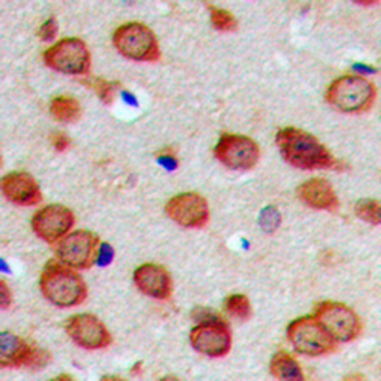DHAPAT Antibody