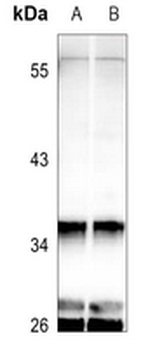 GNAT1 Antibody