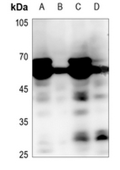 MEN Antibody