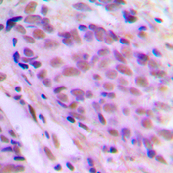 MEN Antibody