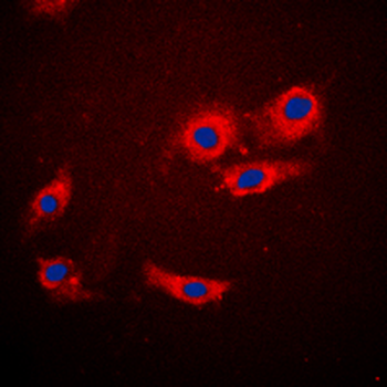 4EBP1 Antibody