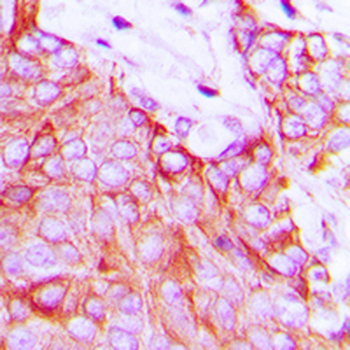 Ephrin A5 Antibody