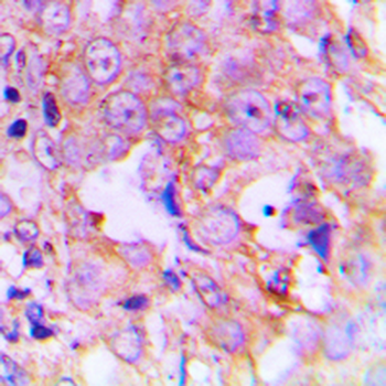 EEF2 (pT56) Antibody