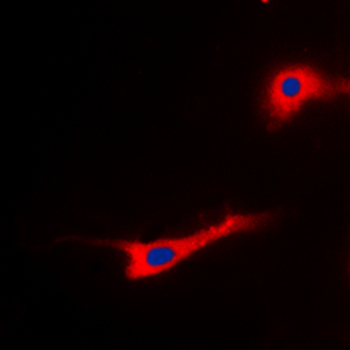 EEF2 (pT56) Antibody
