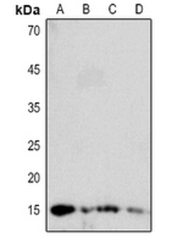 DBI Antibody