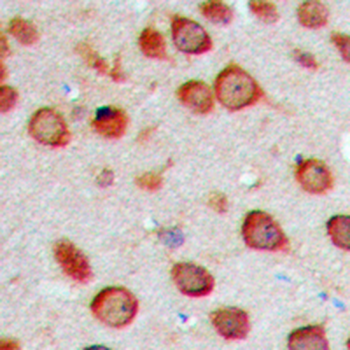 Cytochrome P450 2S1 Antibody
