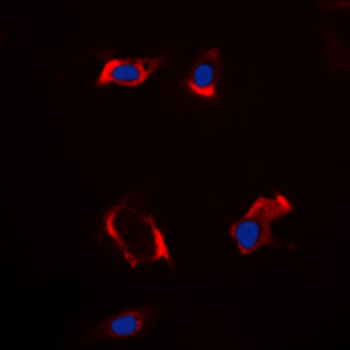 Cytochrome P450 2S1 Antibody