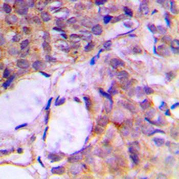 CNK2 Antibody