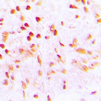 CDCA2 Antibody