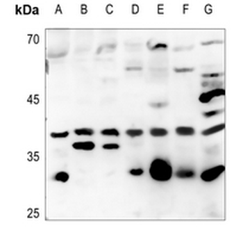 ATF5 Antibody